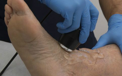 骨折后多久才可以走路 骨折的愈合時(shí)間要多久 骨折后多久才能走路 骨折的恢復(fù)時(shí)間要多久